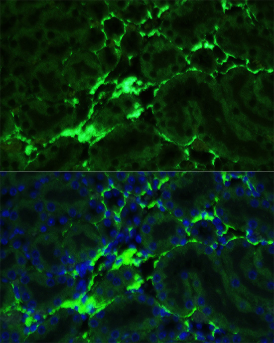 Anti-COL1A1 Antibody (CAB1352)