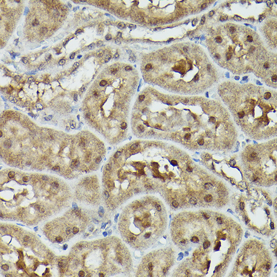 Anti-VCP Antibody (CAB13368)