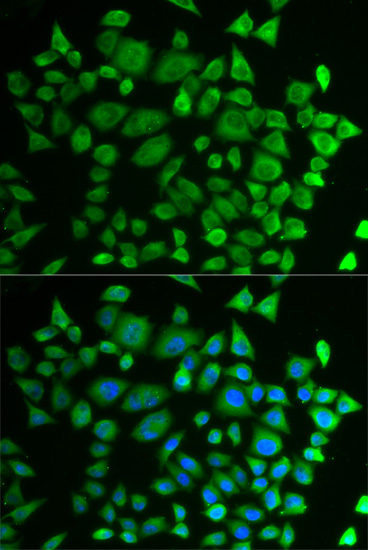 Anti-P4HTM Antibody (CAB13593)