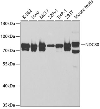Anti-NDC80 Antibody (CAB5411)