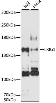 Anti-LRIG1 Antibody (CAB12027)