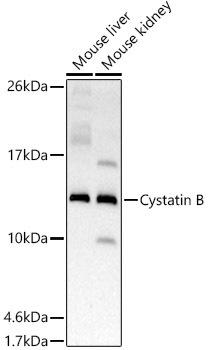 Western blot analysis of extracts of various cell lines, using Cystatin B antibody at 1:500 dilution. Secondary antibody: HRP Goat Anti-Rabbit IgG (H+L) at 1:10000 dilution. Lysates/proteins: 25ug per lane. Blocking buffer: 3% nonfat dry milk in TBST. Detection: ECL Basic Kit. Exposure time: 180s.