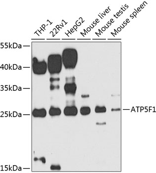 Anti-ATP5F1 Antibody (CAB7645)