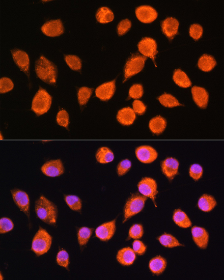 Anti-SMPD4 Antibody (CAB15473)