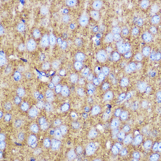 Anti-SNAP25 Antibody (CAB0986)