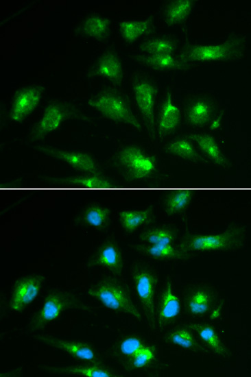 Anti-CD46 Antibody (CAB13515)