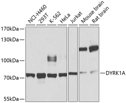 Anti-DYRK1A Antibody (CAB0595)
