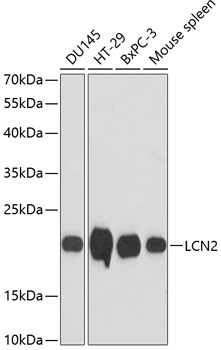 Anti-LCN2 Antibody (CAB2092)