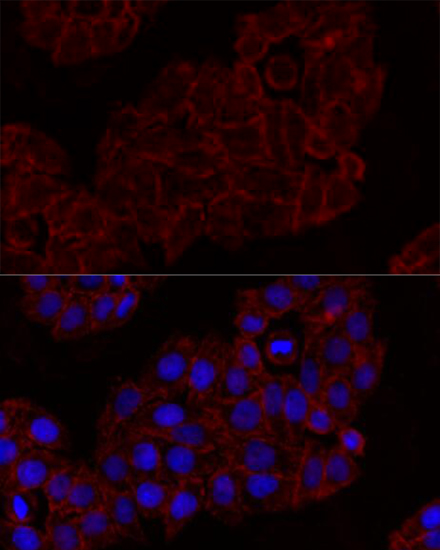 Anti-KLRK1 Antibody (CAB11964)