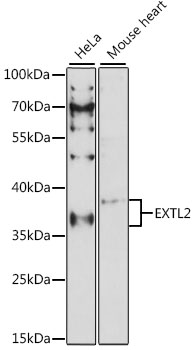 Anti-EXTL2 Antibody (CAB15669)