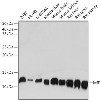 Anti-MIF Antibody