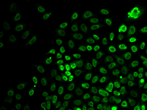 Anti-SMARCA4 Antibody [KO Validated] (CAB0887)