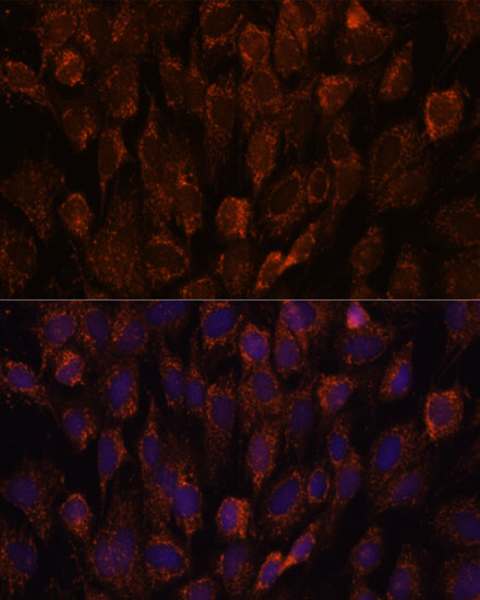 Anti-NSDHL Antibody [KO Validated] (CAB16893)