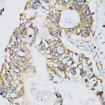 Anti-CHN1 Antibody (CAB7546)