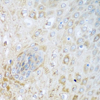 Anti-SIRT3 Antibody (CAB5419)