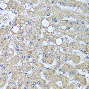 Anti-DCP2 Polyclonal Antibody (CAB8282)