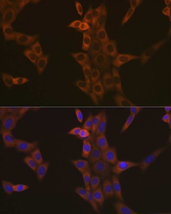 Anti-CASP9 Rabbit Monoclonal Antibody [KO Validated] (CAB18676)