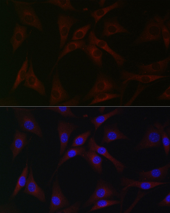 Anti-cIAP2 Antibody (CAB0833)