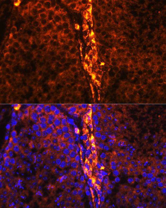 Anti-RBP1 Antibody (CAB10029)