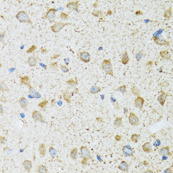 Anti-COG2 Antibody (CAB6251)