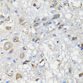 Anti-BCS1L Antibody (CAB7647)