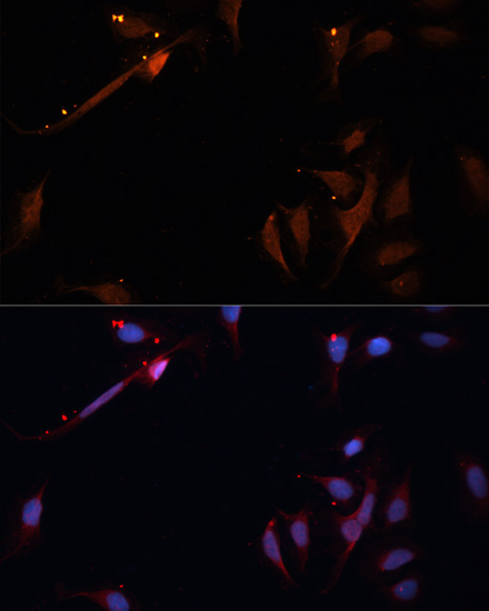 Anti-LPL Antibody (CAB16252)