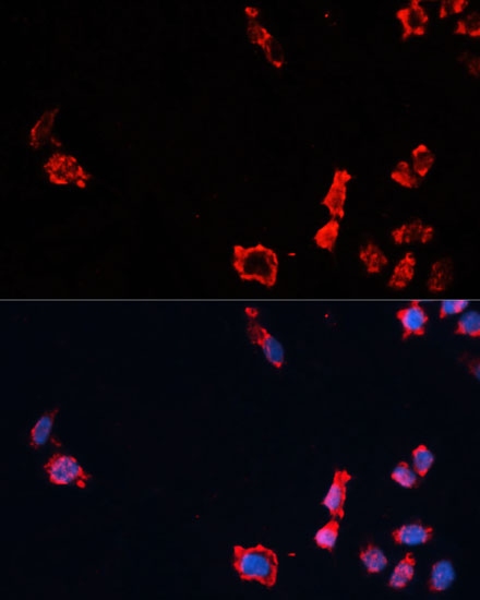 Anti-Caspase-10 Antibody (CAB0169)