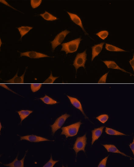 Anti-ATXN2 Antibody (CAB16666)