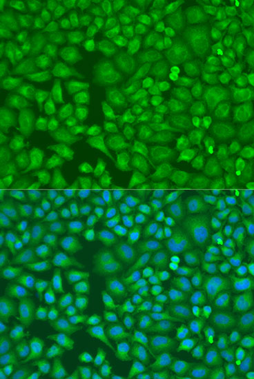 Anti-LLGL2 Polyclonal Antibody (CAB8284)