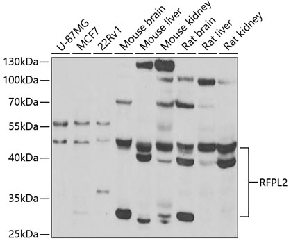 Anti-RFPL2 Antibody (CAB7578)