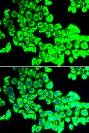 Anti-G3BP1 Antibody (CAB5342)