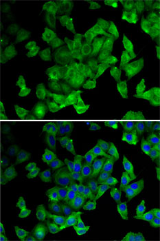 Anti-PPL Antibody (CAB6950)