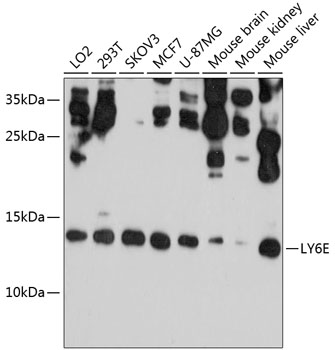 Anti-LY6E Antibody (CAB10225)