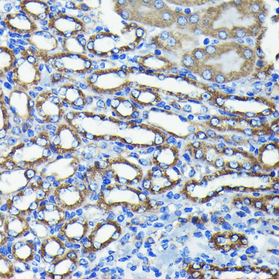 Anti-TTC11 Antibody [KO Validated] (CAB19666)