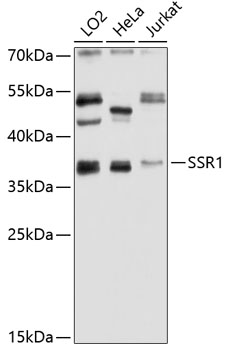 Anti-SSR1 Antibody (CAB4129)