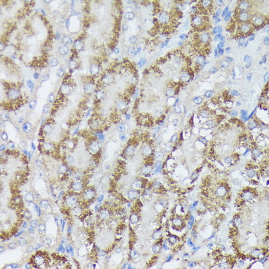 Anti-MTHFD2 Antibody (CAB10386)