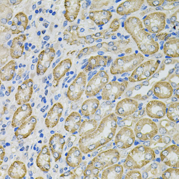 Anti-GLA Antibody (CAB1700)