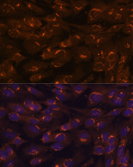 Anti-GALNT2 Antibody (CAB6910)