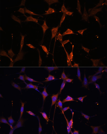 Anti-KEAP1 Antibody (CAB17062)