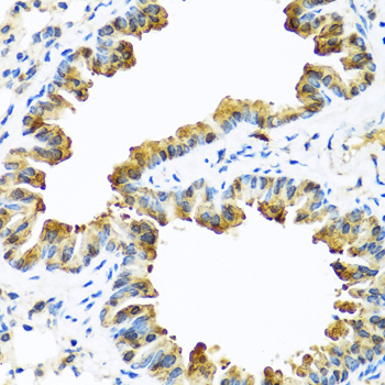 Anti-SERPINA10 Antibody (CAB7106)