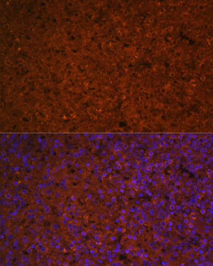 Anti-SLAMF7 Antibody (CAB5782)