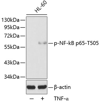 Anti-Phospho-RELA-T505 Antibody (CABP0190)