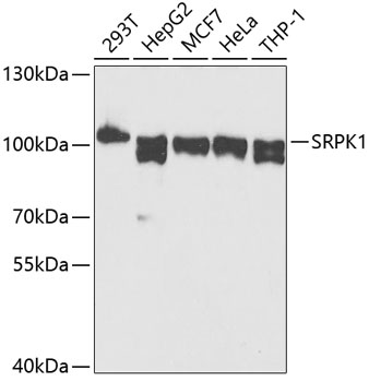 Anti-SRPK1 Antibody (CAB12510)