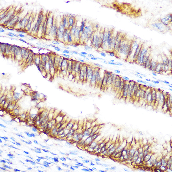 Anti-Raf1 Antibody (CAB0223)