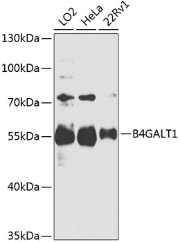 Anti-B4GALT1 Polyclonal Antibody (CAB8546)