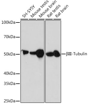 Anti-BetaIII-Tubulin Rabbit Monoclonal Antibody (CAB17913)