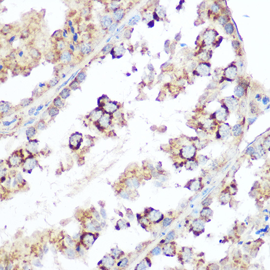 Anti-DIABLO Antibody (CAB2564)