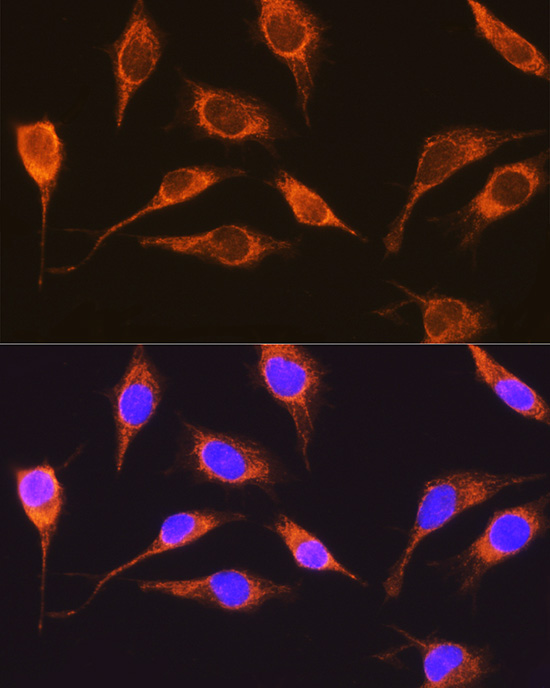 Anti-RCN1 Antibody (CAB10572)