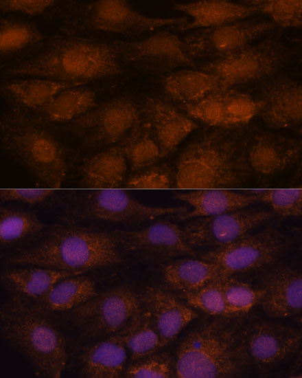 Anti-CEP85 Antibody (CAB15891)