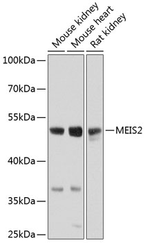 Anti-MEIS2 Polyclonal Antibody (CAB8437)